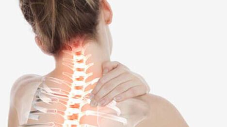 Osteocondrosis de la columna cervical