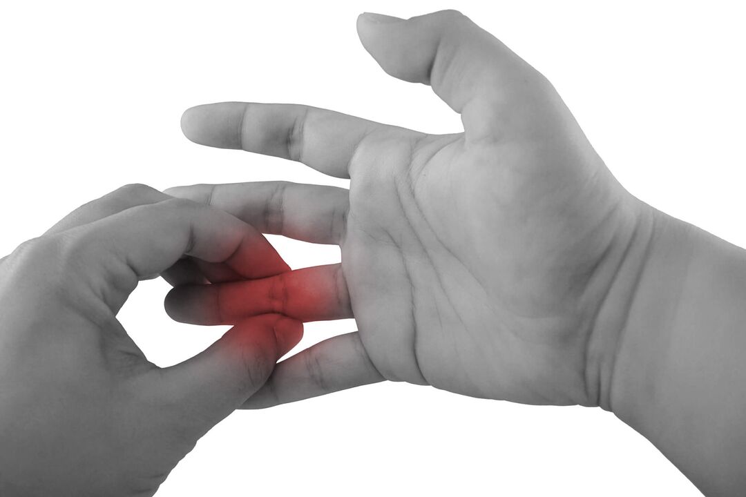 Inflamación en las articulaciones de los dedos como causa de dolor. 