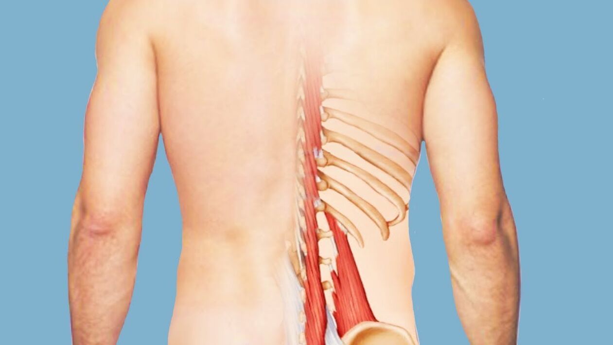 Miositis como causa de dolor de espalda. 