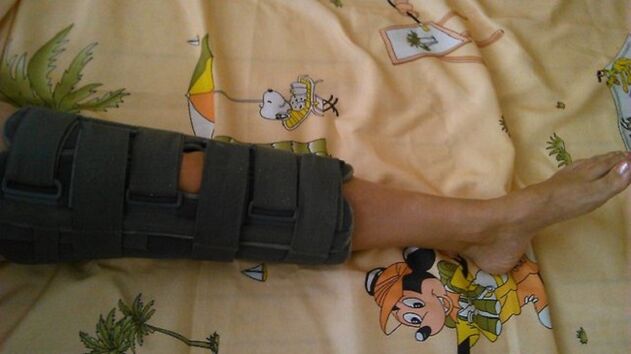 Inmovilización de la articulación de la rodilla en caso de dolor. 